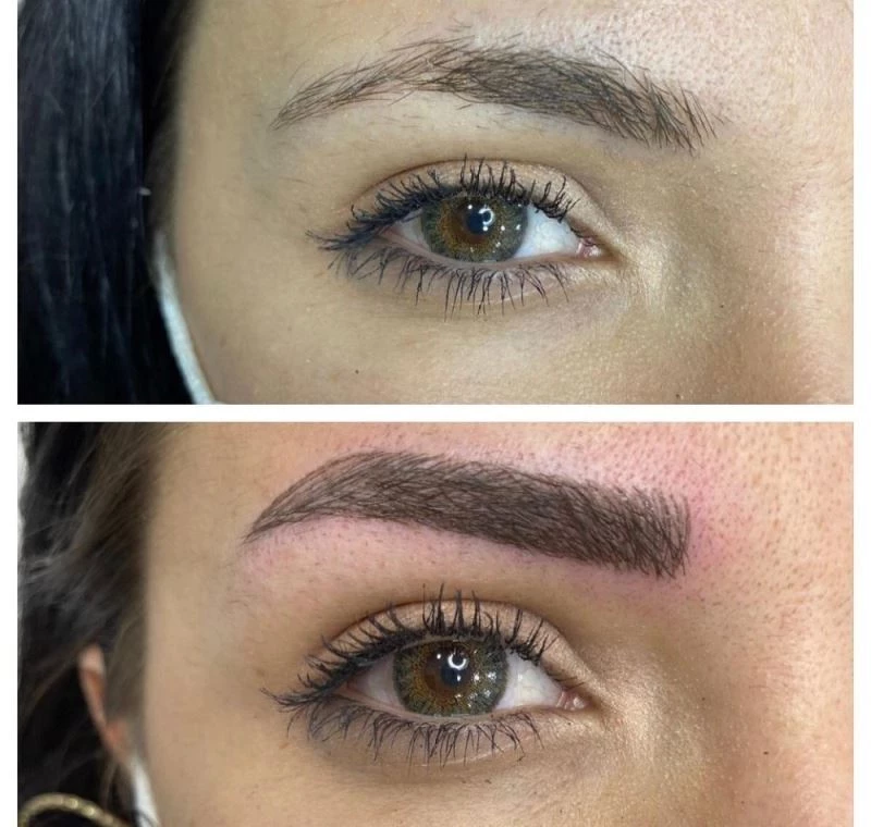 Dilan Polat Ataşehir’de kadınlar HydraFacial’la güzelleşiyor
