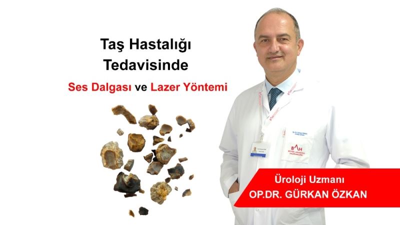 Taş hastalığı tedavisinde ’ses dalgası’ ve ’lazer’ yöntemi
