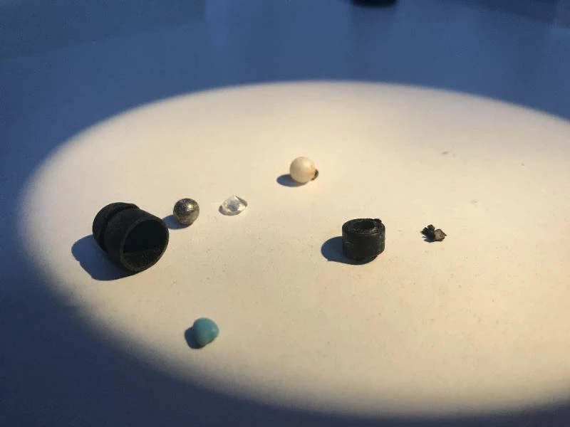 Kulak burun boğaz uzmanı Ali Fuat Şaşoğlu: “Hastanın burnundan 15 yıl sonra tespih boncuklarını çıkarttık”
