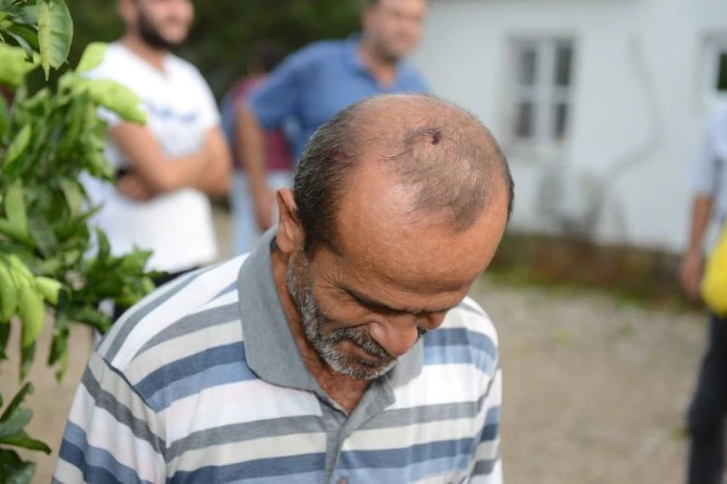 Doluya açık alanda yakalandı, başından yaralandı
