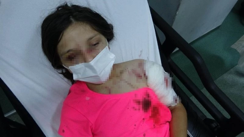 Kız çocuğuna dehşeti yaşatan pitbullun sahibine ceza yağacak
