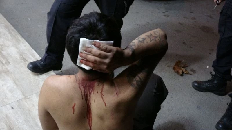 Hem kısıtlamaya uymayıp alem yaptılar, hem de yaralıyı ambulansta linç etmeye çalıştılar
