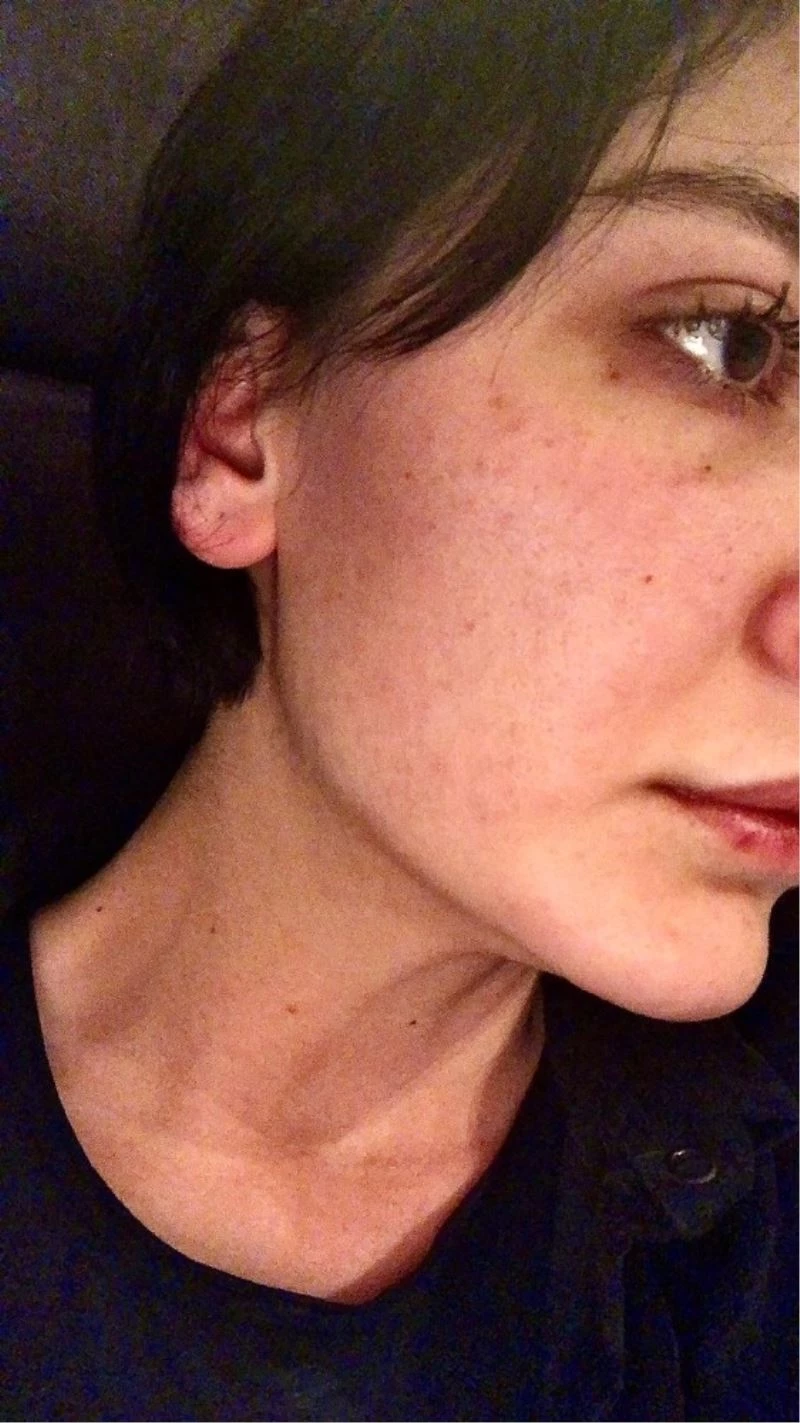 Oyuncu Sevcan Yaşar’ın darp edilmesine ilişkin fotoğraflar dava dosyasına girdi
