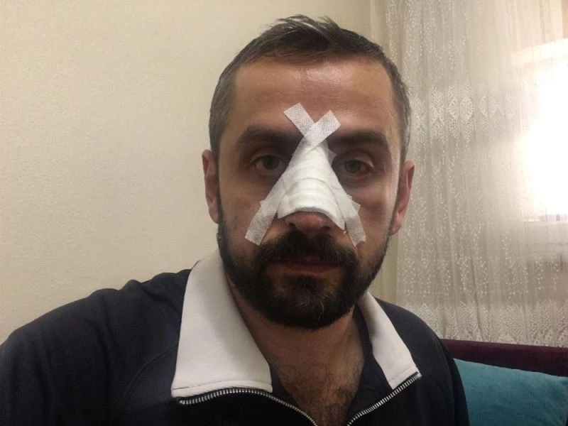 Gazetecilerin can güvenliği tehlikede
