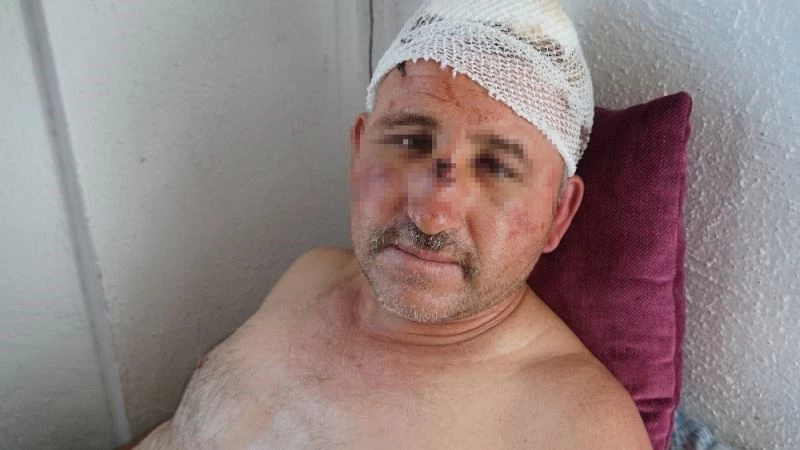 Taciz ettiği iddiasıyla karı-koca tarafından öldüresiye dövülen adamdan şok iddialar
