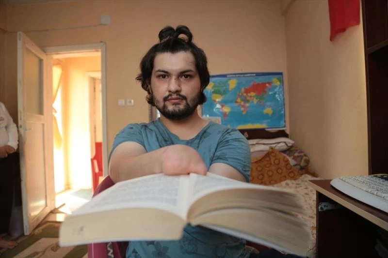 Elsiz ve ayaksız doğdu ama hayata sıkı sıkı sarıldı