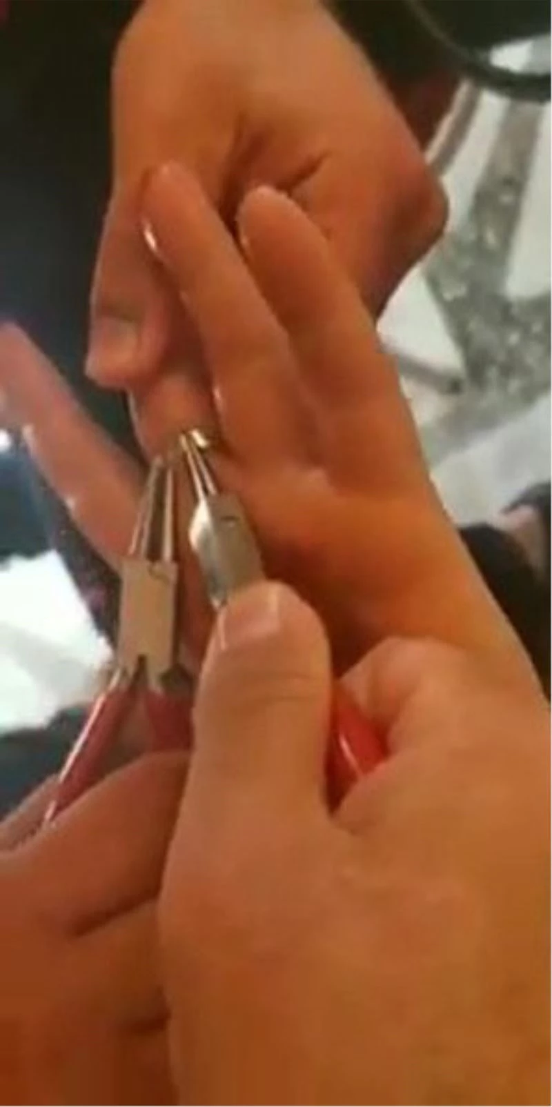 Parmağa sıkışan yüzüğü itfaiye ekipleri çıkardı
