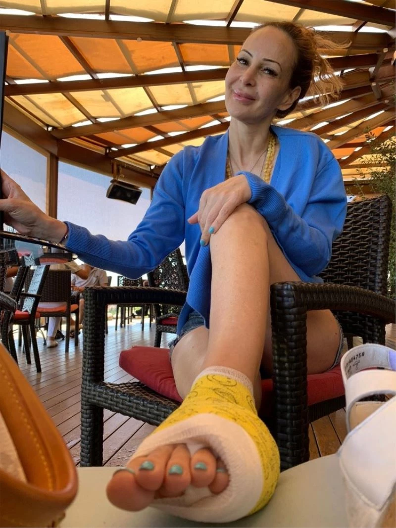 Manken Alexandra Ceylan, yavru köpeği kurtarırken ayağını kırdı
