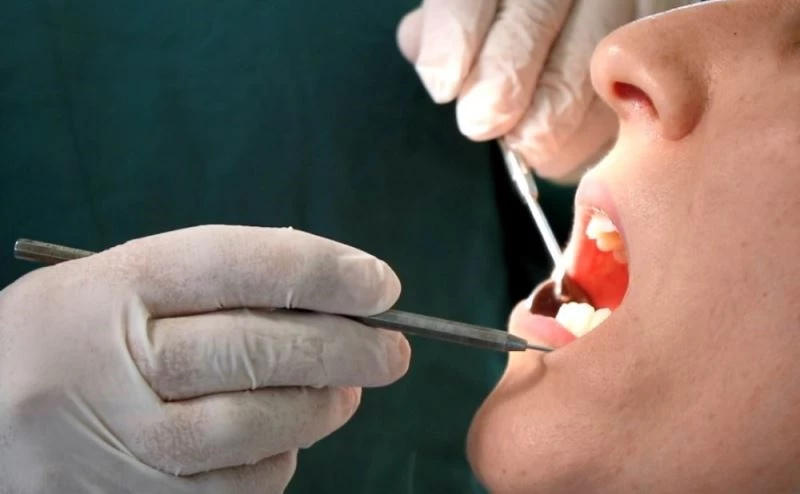 Kırılan diş dolgusu yeni problemlere yol açabilir
