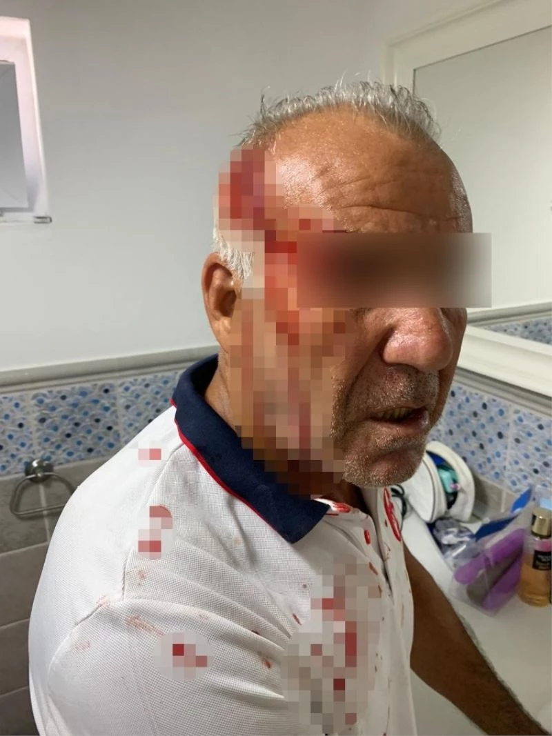 ’Siz kiracısınız, bu yolu kullanmayın’ kavgası kanlı bitti
