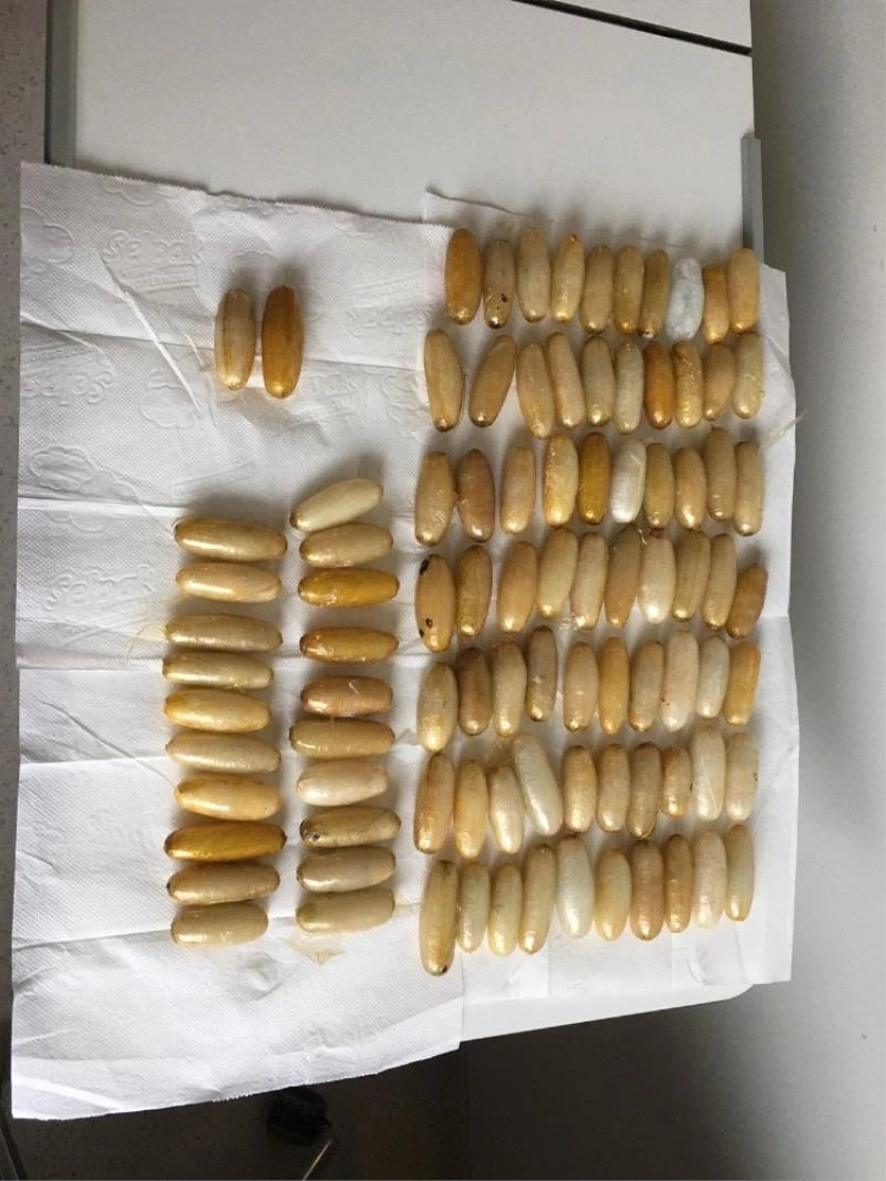 İstanbul Havalimanı’nda yolcunun midesinden 93 kapsül uyuşturucu çıktı

