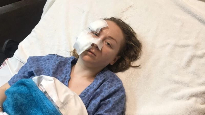 (Özel) Falçatalı saldırıya uğrayan Ukraynalı kadın o anları anlattı
