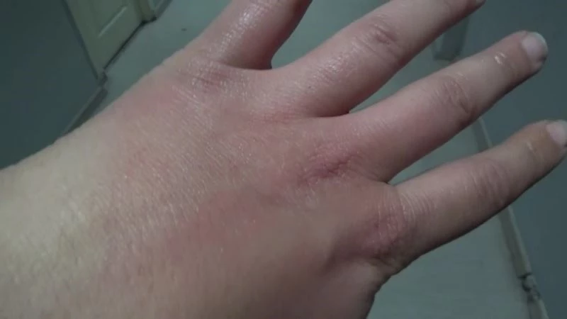 Doğal yöntemle soğuktan ellerinizi ve dudaklarınızı koruyun
