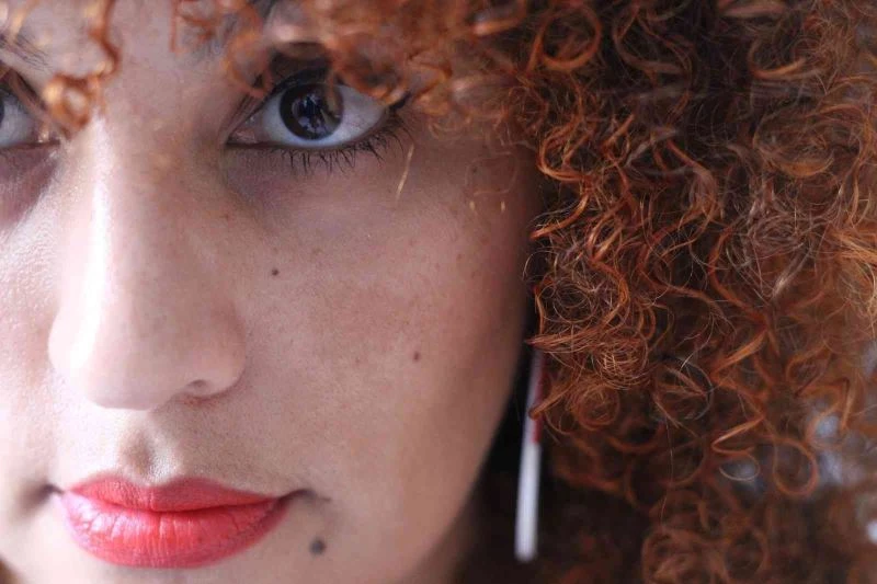 ’’Leke tedavileri uzun solukludur ve sabır gerektirir’’
