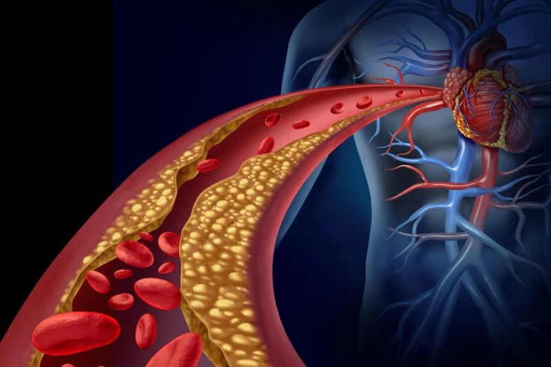 Yüksek kolesterollü hastalara yeni umut: Kolesterol aşısı

