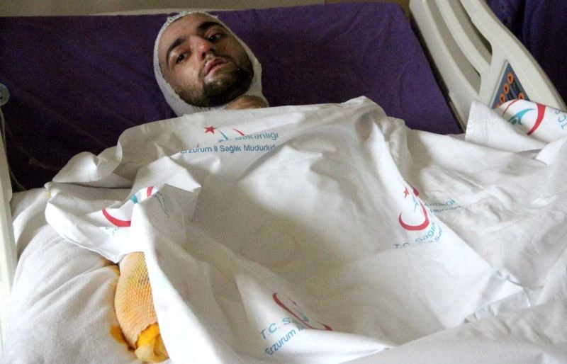 Banyo yapmak için sobaya benzin döktü, feci şekilde yandı
