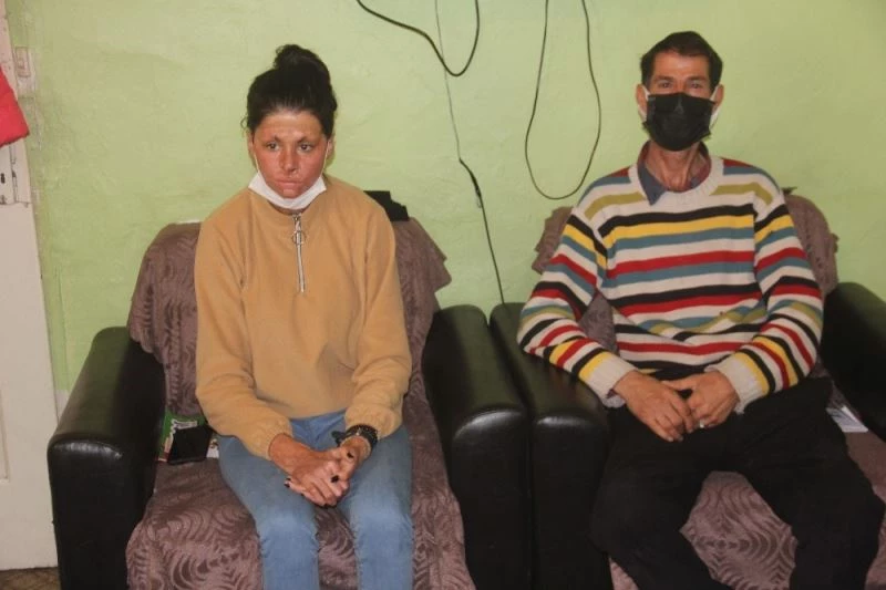 Bitlenen saçlarını benzinle yıkamak isterken kendini yakan kız yardım eli bekliyor
