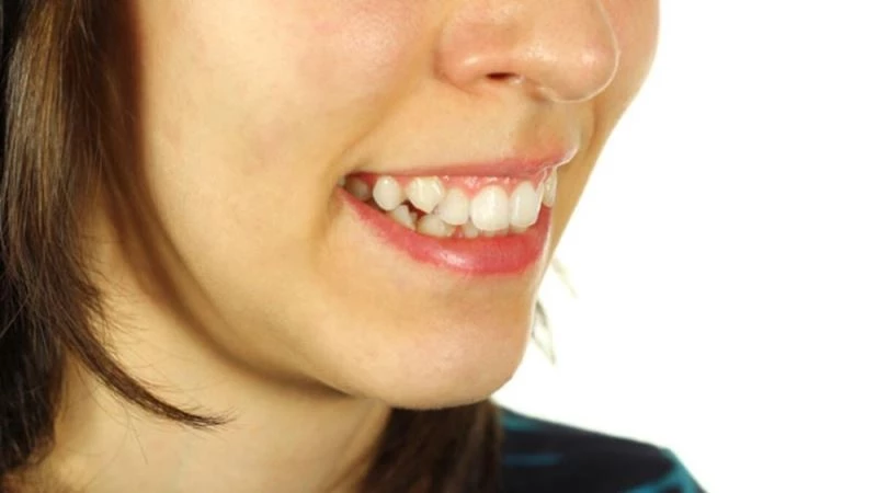 Ağızdan nefes almak, diş yapısını bozabilir
