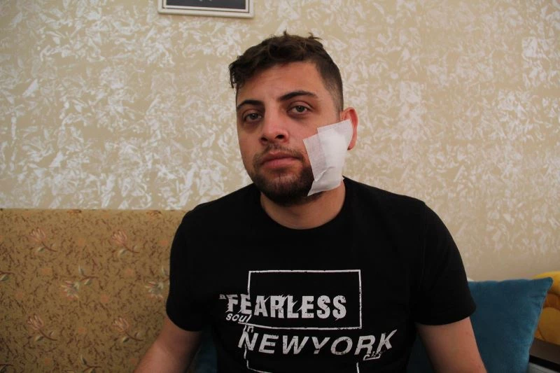 Kadına tokat attı diye uyardı, çatalla yüzünen yaralanıp hastanelik oldu
