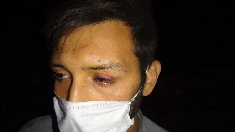 Hırsızlar görevliyi hortumla döverek bayılttı
