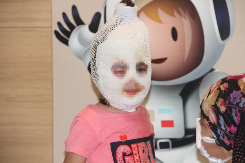 Kaynar suyu üzerine döken çocuk feci şekilde yandı
