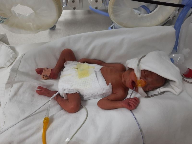 850 gram doğan Müge bebek, hayata tutunmayı başardı
