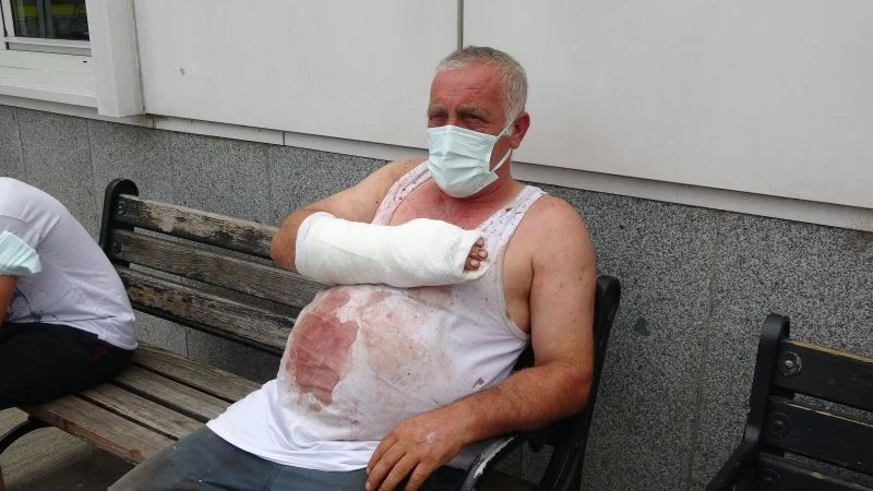 Kurban keserken arkadaş kurbanı oldu
