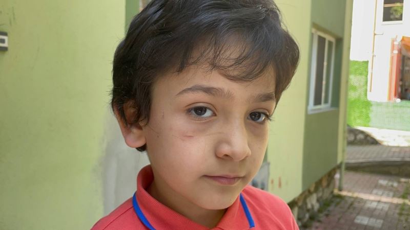 Sokak köpeği 8 yaşındaki Mehmet’in yanağını koparıyordu

