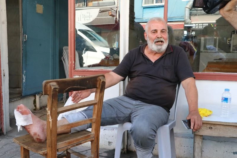 Ayağından vuruldu ambulansı gülerek bekledi
