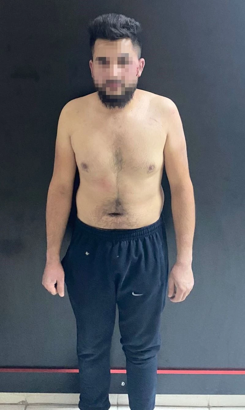 Altındağ’daki bıçaklı saldırının zanlıları tutuklanarak cezaevine gönderildi
