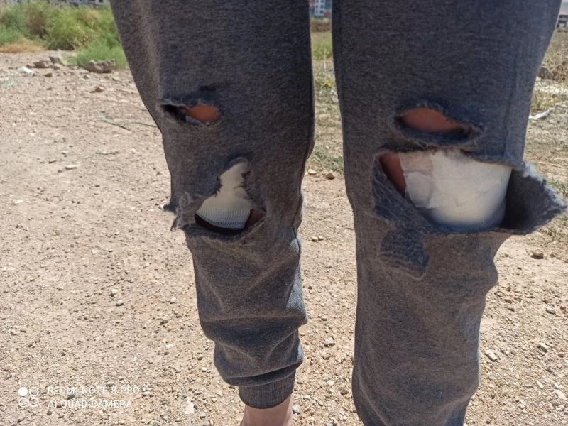 Başkent’te başıboş köpeklerin saldırısına uğrayan kadın canının zor kurtardı
