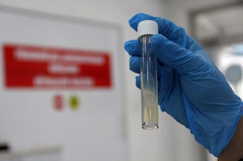 Tüberkülozda erken tanı sürecini hızlandıran yeni yöntem kullanıma sunulacak