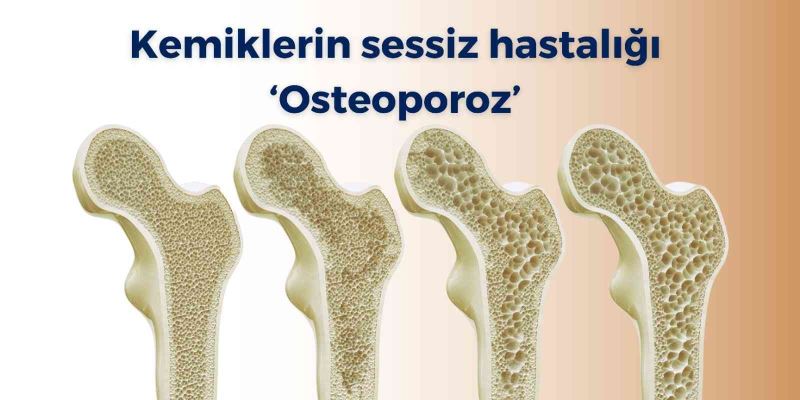 Kemiklerin sessiz hastalığı ‘osteoporoz’
