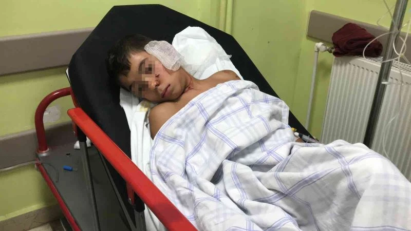 Sahipsiz köpeklerin dehşeti yaşattığı çocuğun annesi: 