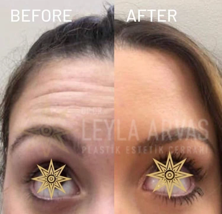 Yaşınız Yüzünüzden Okunmasın