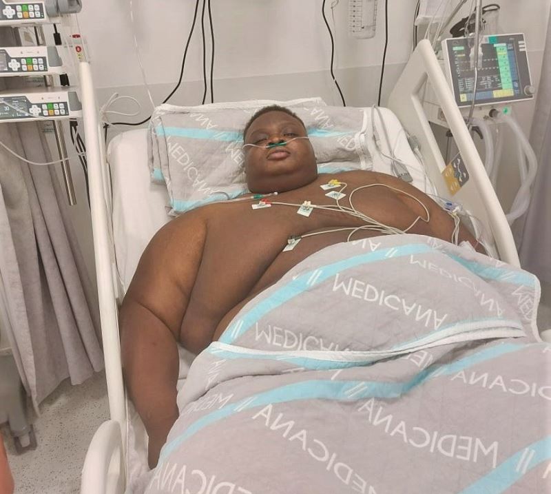 Nijerli 200 kilogram ağırlığındaki süper obez midesini Türkiye’de bıraktı
