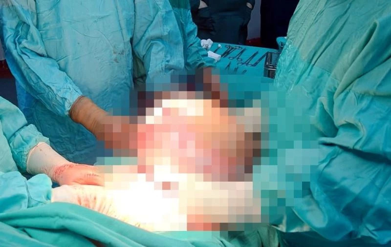 Karnından 7,5 kilo kitle çıktı
