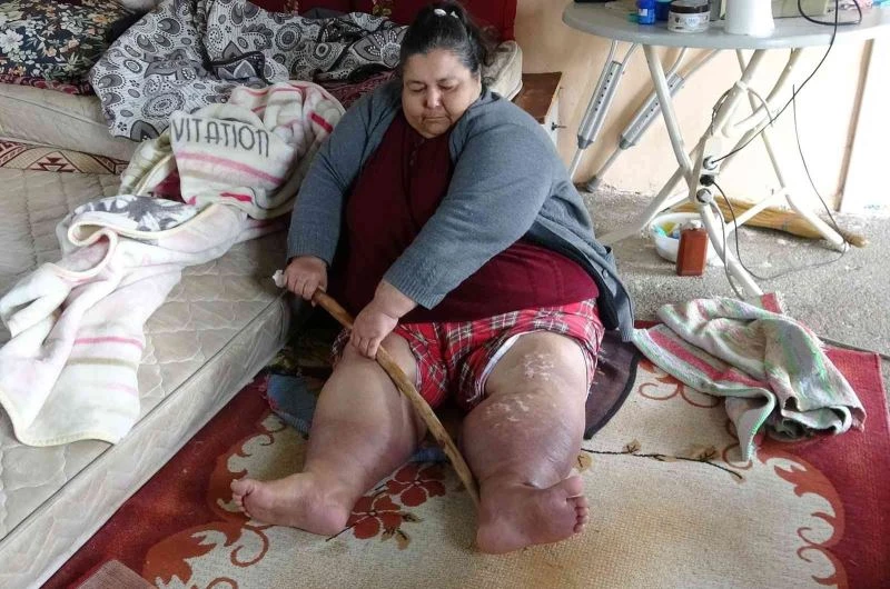 Tek odalı evde hasta anneye engelli oğlu, devlet ve komşuları bakıyor
