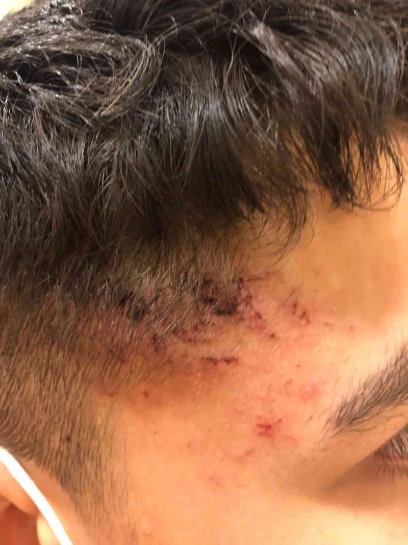 Almanya’da 13 yaşındaki Emirhan Altıntaş’a polis şiddeti kamerada
