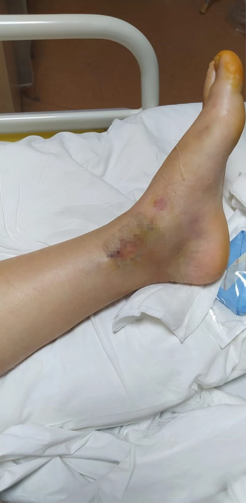 Kaza sonrası kaçan alkollü sürücü ‘kasten öldürmeye teşebbüs’ten tutuklandı
