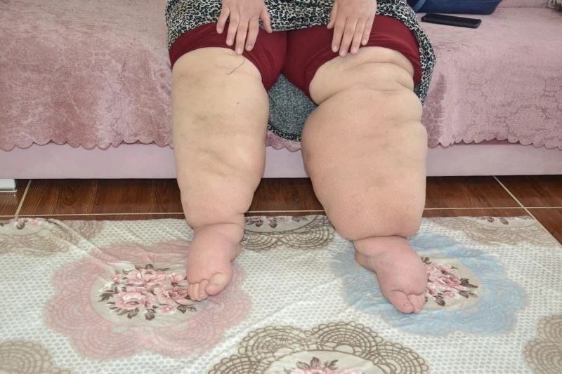 15 yıldır hastalığına teşhis konulmayan kadının hayatı kabusa döndü
