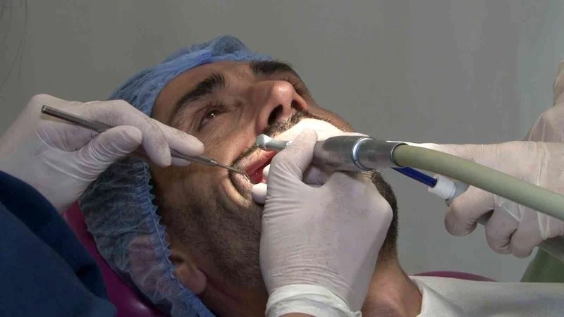 Yabancı turistlerden diş estetiğinde ‘Hollywood Smile’ ilgisi
