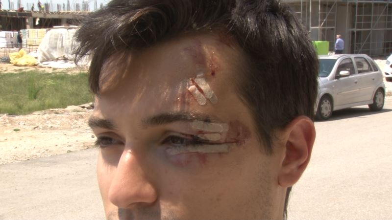Bisikletiyle üniversiteye giden öğrenci sokak köpeklerinin saldırısına uğradı
