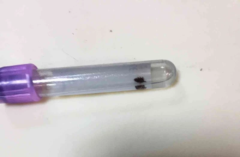 Vücuduna yapışan kene acil serviste çıkarıldı
