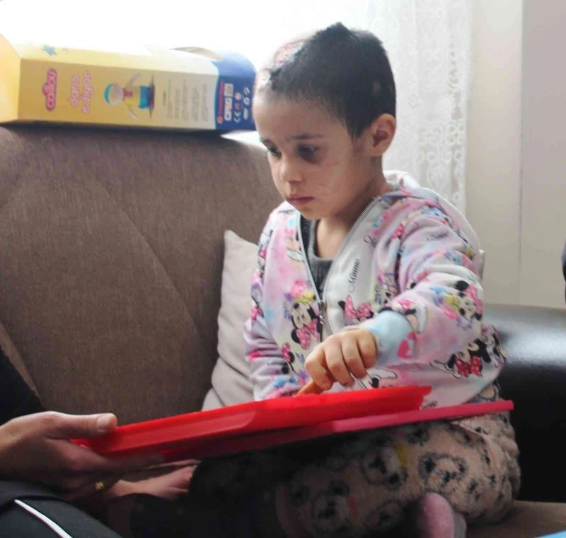 Pitbull saldırısına uğrayan Asiye’nin görüntüleri tepki topladı
