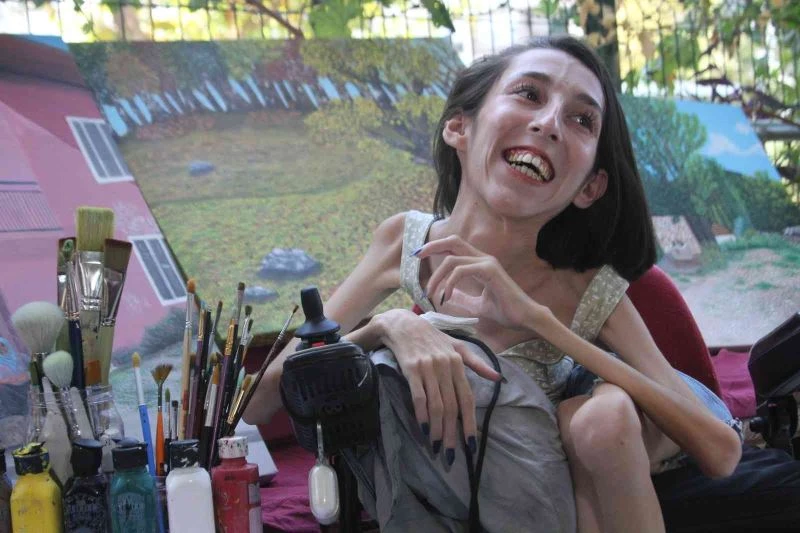 SMA’lı Gülçin’in engelli aracı üzerinde çizdiği resimler belgesele konu oldu
