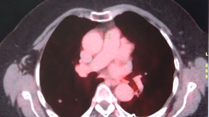 Diyarbakır’da kanser hastaları son nükleer tıp teknolojileriyle şifa buluyor
