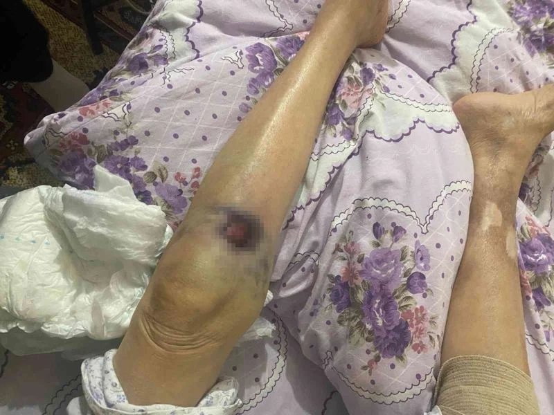Ankara’da bakıcı dehşeti: 91 yaşındaki yaşlı kadın hastanede ölüm kalım savaşı veriyor

