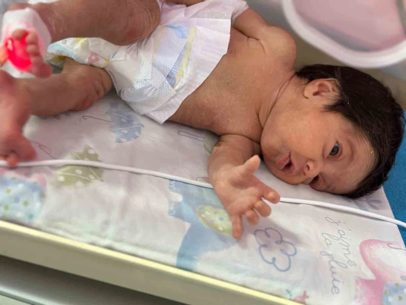 Depremzede Asel bebek, Adana’da hayata tutundu