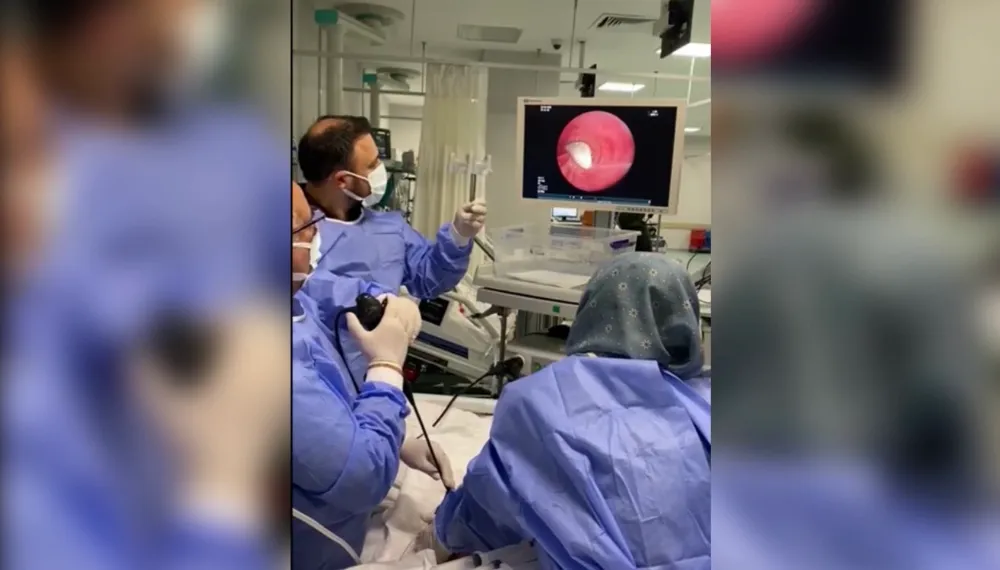 Osmaniye’de, 70 yaşındaki hastanın akciğerine kaçan tüm sarımsak başarıyla çıkartıldı